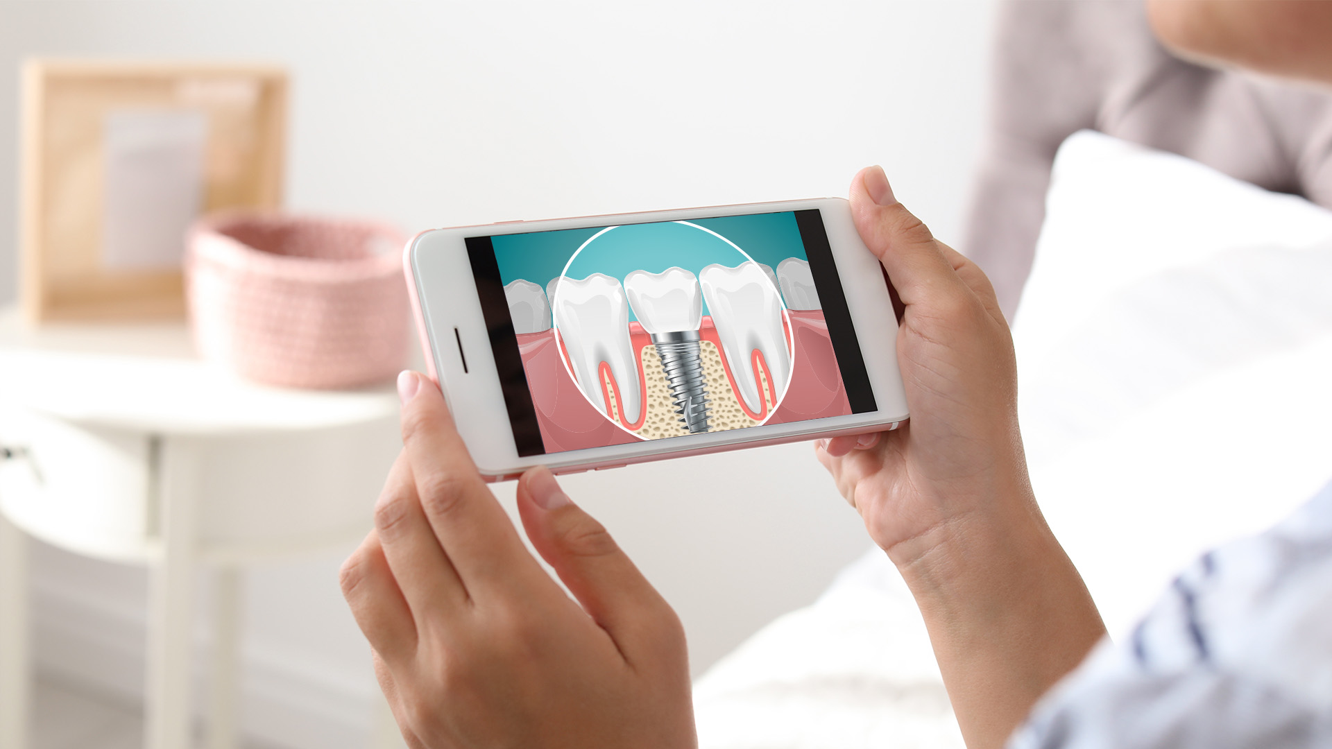 A person holding a smartphone displaying an image of a tooth with a cavity on a screen.