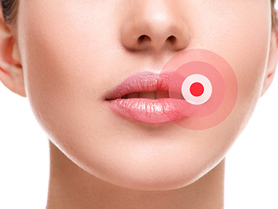The image features a close-up of a person s face with a red circle highlighting their lips, suggesting a focus on lip care or beauty products.