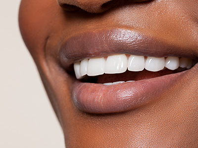 The image shows a close-up of a person s smiling face with teeth, displaying a happy expression.