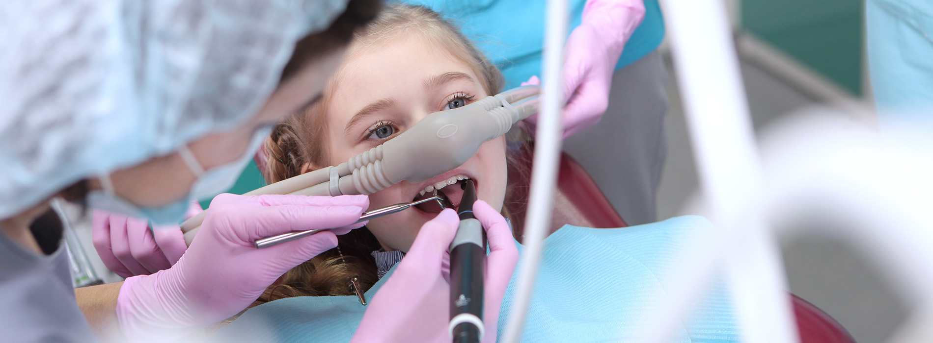 A young girl is being attended to by dental professionals with an oxygen mask on her face.