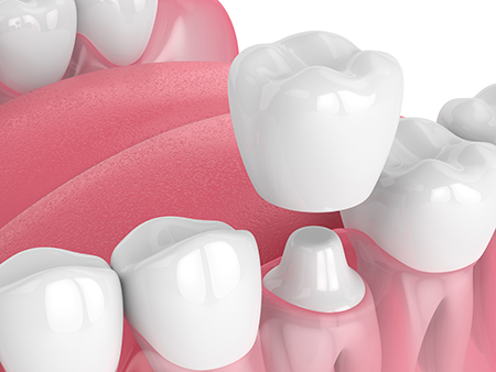 The image shows a collection of white teeth with pink gums against a white background, with an arrangement of these dental structures forming a circular pattern.