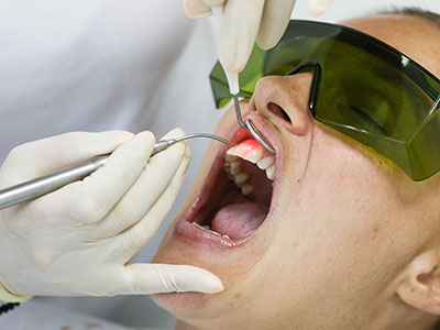 A person in a dental chair receiving dental treatment with a dentist performing the procedure.